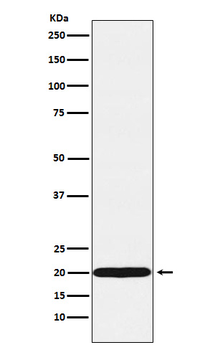 UBE2C Rabbit Monoclonal Antibody
