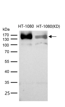 ATP7b Rabbit mAb [KD Validated] Antibody
