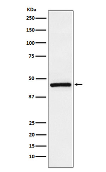 TMEFF2 Rabbit mAb Antibody
