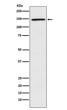 PLCG2 Rabbit mAb Antibody