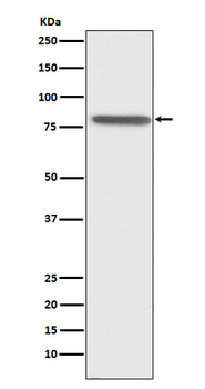 PSAP Rabbit mAb Antibody