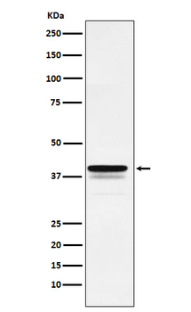 FOXF1 Rabbit Monoclonal Antibody