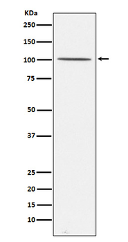 Gemin 3 Rabbit mAb Antibody