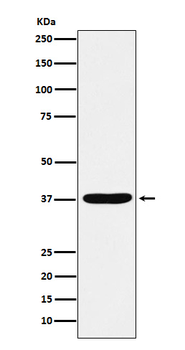 AKR1C1 / AKR1C2 Rabbit mAb Antibody