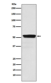 ACM2 Rabbit Monoclonal Antibody