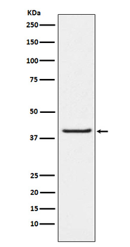 PAR4 Rabbit mAb Antibody