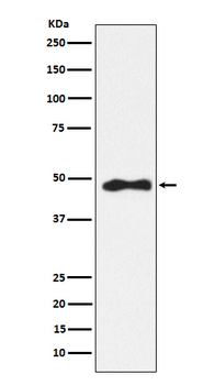 AP2 alpha Rabbit mAb Antibody