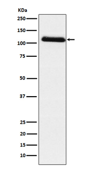 Fibrinogen alpha chain Rabbit mAb Antibody
