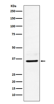 LDHB Rabbit mAb Antibody