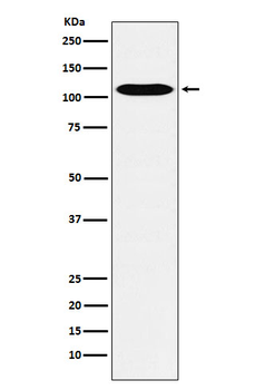 GPCR / LGR6 Rabbit mAb