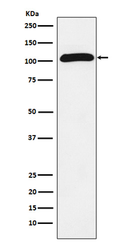 ROR2 Rabbit Monoclonal Antibody