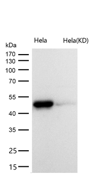 Galactosidase alpha Rabbit mAb