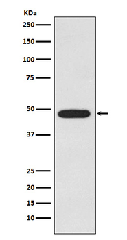 Galactosidase alpha Rabbit mAb