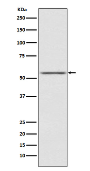 AMHR2 Rabbit mAb Antibody