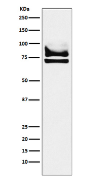 DDX17 Rabbit mAb Antibody