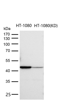 DGAT1 Rabbit mAb Antibody