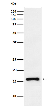CDKN2C Rabbit mAb [KD Validated]
