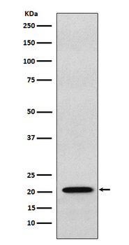 RAP1A + RAP1B Rabbit mAb Antibody