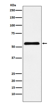 CBX2 Rabbit mAb [KD Validated]
