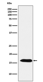 Peroxiredoxin 5 Rabbit mAb Antibody