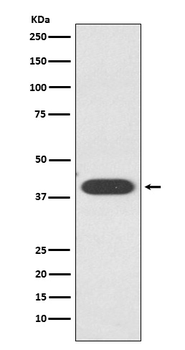 ZA2G / AZGP1 Rabbit mAb Antibody