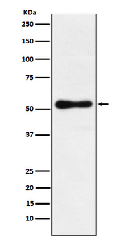 ROR beta Rabbit mAb Antibody