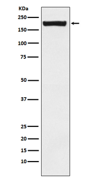 MRC2/ENDO180 Rabbit Monoclonal Antibody