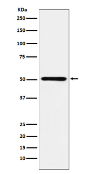 RING1 Rabbit mAb [KD Validated] Antibody