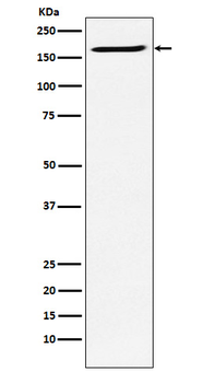 SMC4 Rabbit Monoclonal Antibody