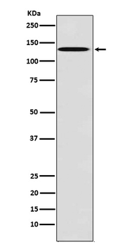 TYRO3 Rabbit mAb Antibody