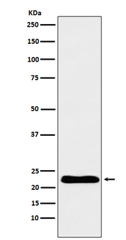TNNI1 Rabbit mAb Antibody