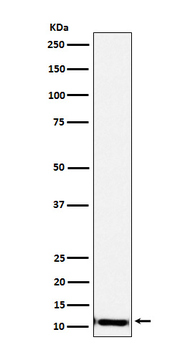 SPINK1 Rabbit Monoclonal Antibody