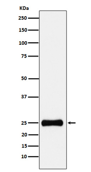 PSMA2 Rabbit mAb Antibody
