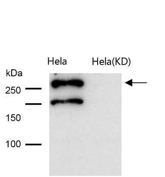 Desmoplakin Rabbit mAb Antibody