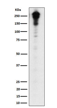 Desmoplakin Rabbit mAb Antibody