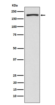 EHMT2/G9A Rabbit mAb [KD Validated]
