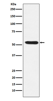 TEAD1/2/3/4 Rabbit mAb Antibody