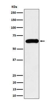 SQSTM1 / p62 Rabbit mAb Antibody