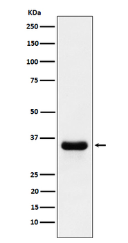 PSMD14 Rabbit Monoclonal Antibody
