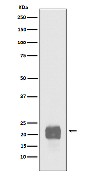Cripto1 Rabbit mAb Antibody