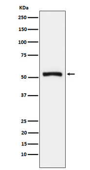 Tryptophanyl tRNA synthetase Rabbit mAb Antibody