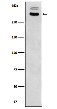 Thyroglobulin Rabbit mAb Antibody