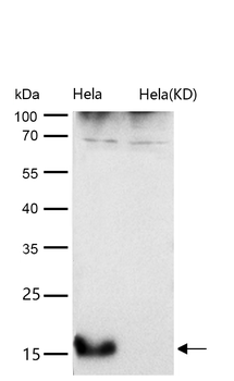 AP2S1 Rabbit mAb [KD Validated]
