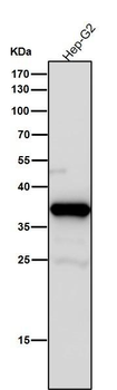 AKR1C3 Rabbit mAb