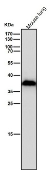 AKR1C3 Rabbit mAb