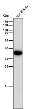 AKR1C3 Rabbit mAb