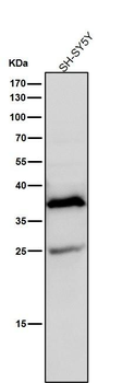 AKR1C3 Rabbit mAb