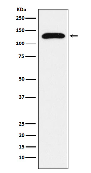 TRPC1 Rabbit mAb Antibody