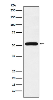 TAB1 Rabbit mAb Antibody