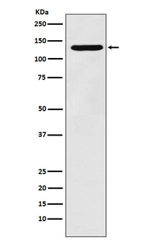 PCB Rabbit mAb Antibody